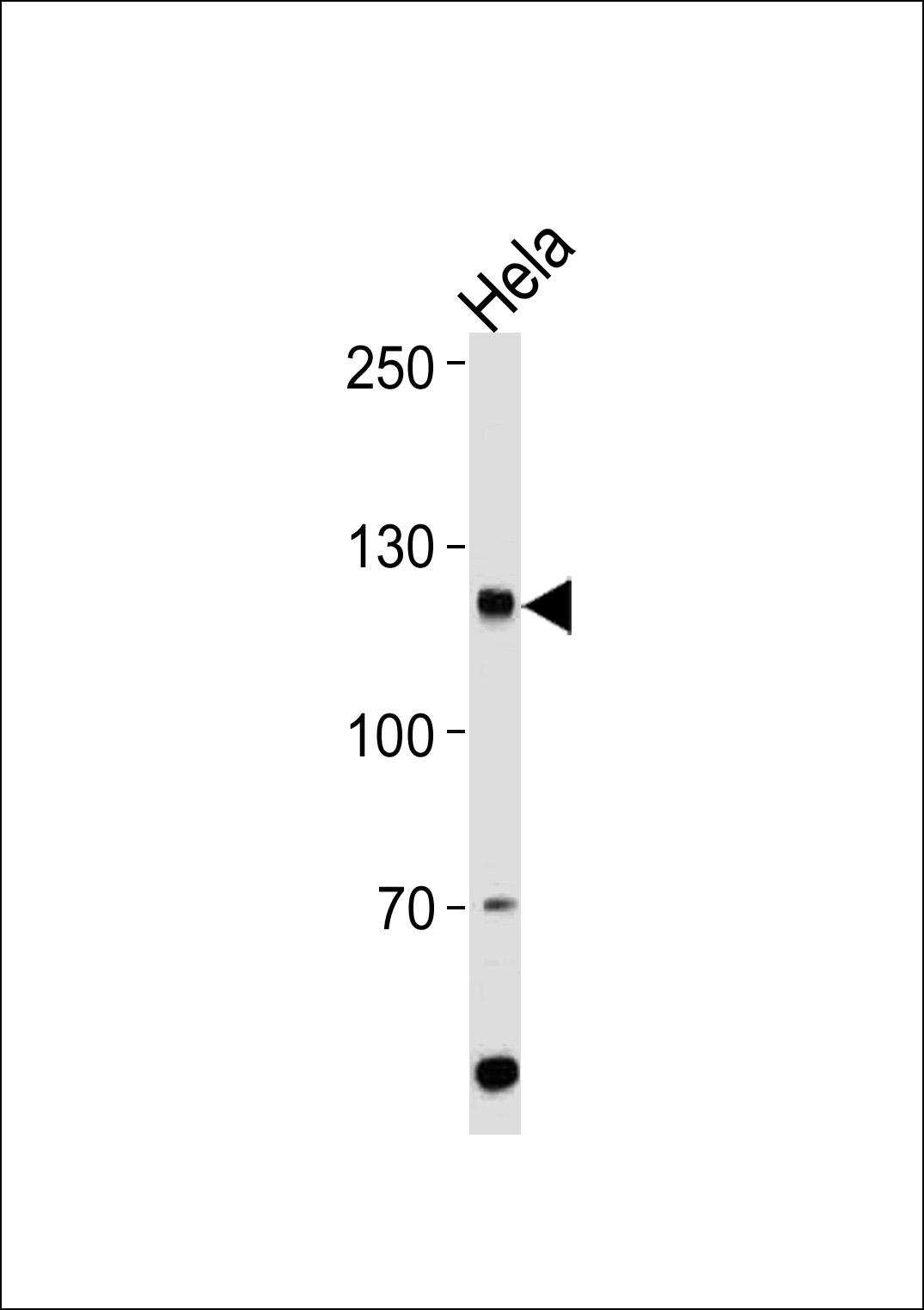 Rabbit Polyclonal Antibody to HIRA