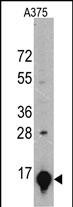 Mouse Monoclonal Antibody to GLT