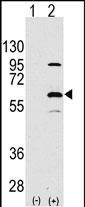 Rabbit Polyclonal Antibody to ELP3 (N-term)