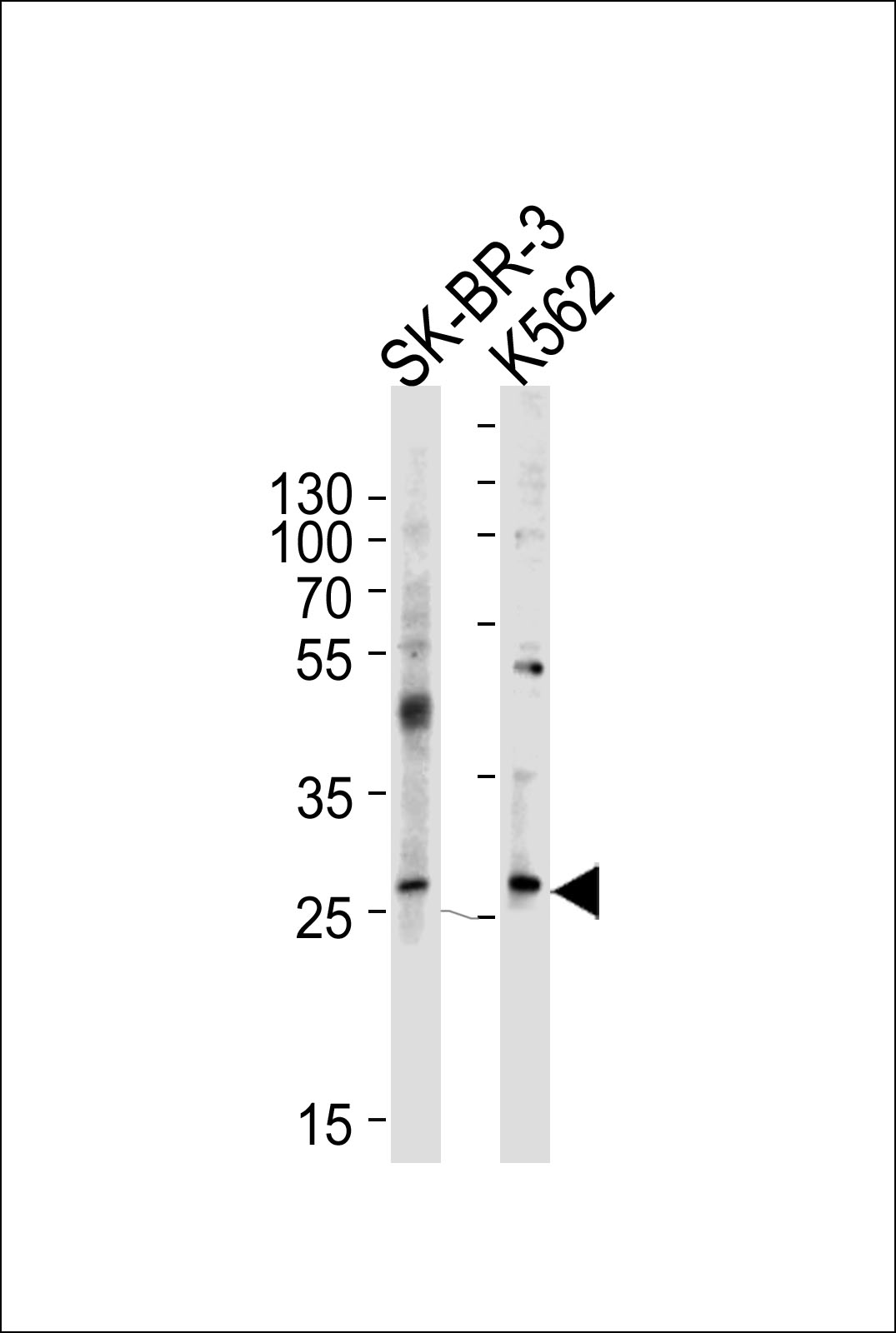 Rabbit Polyclonal Antibody to FRAT1
