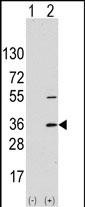 Rabbit Polyclonal Antibody to SSR1 (N-term)