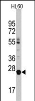 Rabbit Polyclonal Antibody to LIN28B