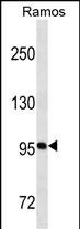 Rabbit Polyclonal Antibody to CD19
