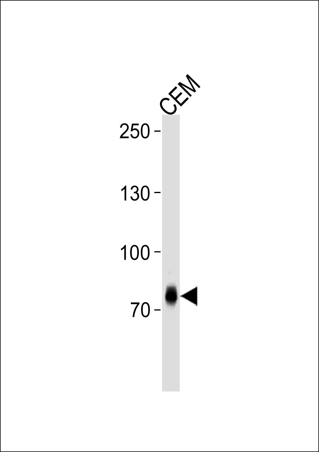 Rabbit Polyclonal Antibody to ZNF219