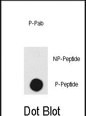 Rabbit Polyclonal Antibody to Phospho-DNA-PK(T2609)
