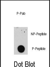Rabbit Polyclonal Antibody to Phospho-E2F1(S332)