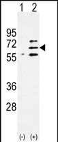 Rabbit Polyclonal Antibody to Parp6 (C-term 503)