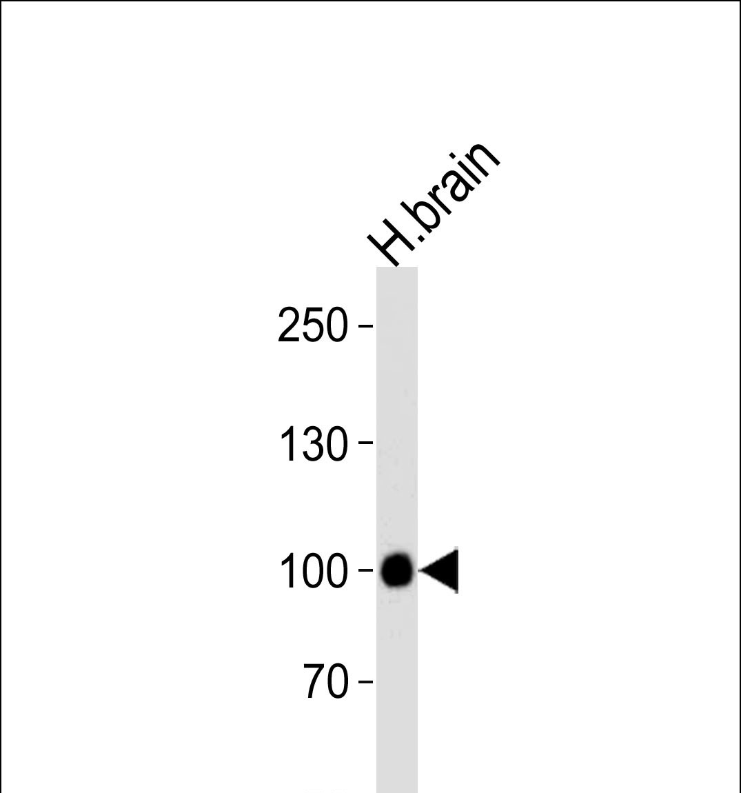Rabbit Polyclonal Antibody to H Cadherin (CDH13) (N-term)