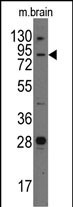 Rabbit Polyclonal Antibody to Junctophilin 3