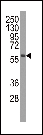Mouse Monoclonal Antibody to PINK1