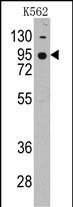 Rabbit Polyclonal Antibody to CDH7 (N-term)