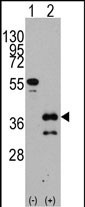 Rabbit Polyclonal Antibody to ZIC4