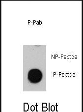 Rabbit Polyclonal Antibody to Phospho-ATM(S1981)