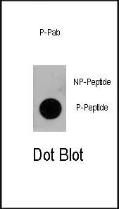 Rabbit Polyclonal Antibody to Phospho-CD133-pY828