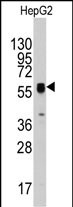 Rabbit Polyclonal Antibody to ECGF1