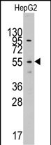 Rabbit Polyclonal Antibody to LAP3 (N-term)