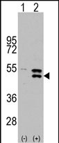 Rabbit Polyclonal Antibody to MAP2K5 (S149)
