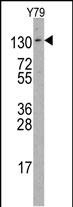 Rabbit Polyclonal Antibody to ABL2 (R432)