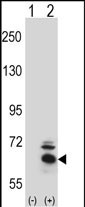 Rabbit Polyclonal Antibody to BBS4