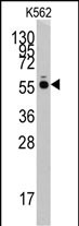 Rabbit Polyclonal Antibody to HARS (N-term)