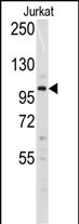 Rabbit Polyclonal Antibody to Dnmt3a (N-term R46)
