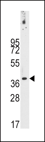 Rabbit Polyclonal Antibody to PDX1 (T11)