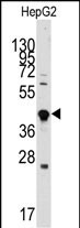 Rabbit Polyclonal Antibody to GDF3