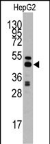 Rabbit Polyclonal Antibody to S adenosylhomocysteine hydrolase (ACHY)