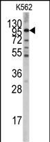 Rabbit Polyclonal Antibody to LGR5 (GPR49)