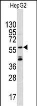 Rabbit Polyclonal Antibody to ANGEL2