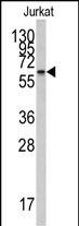 Rabbit Polyclonal Antibody to CYP26A1