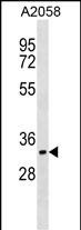 Rabbit Polyclonal Antibody to CDK5R1(p35)