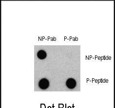 Rabbit Polyclonal Antibody to Phospho-LC3C(S12)
