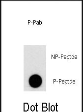 Rabbit Polyclonal Antibody to Phospho-PI3KC3(S676)