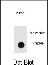 Rabbit Polyclonal Antibody to Phospho-ANTXR1(Y382)