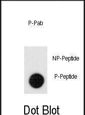 Rabbit Polyclonal Antibody to Phospho-Leo1(S551)