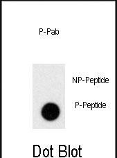 Rabbit Polyclonal Antibody to Phospho-PRL(S163)