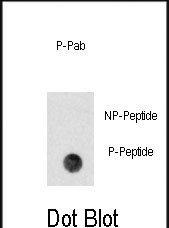 Rabbit Polyclonal Antibody to Phospho-PBK(Y74)
