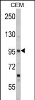 Rabbit Polyclonal Antibody to SEMA3A