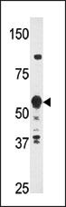 Rabbit Polyclonal Antibody to HDBP2(HDRF-2)