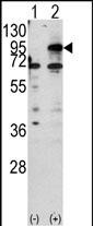 Rabbit Polyclonal Antibody to CPT1B