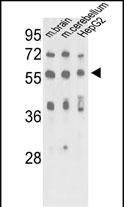 Rabbit Polyclonal Antibody to MeCP2
