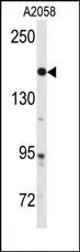 Rabbit Polyclonal Antibody to ABL1Y251)-Antibody