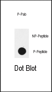 Rabbit Polyclonal Antibody to Phospho-EGFR(Y1172)