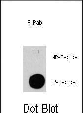 Rabbit Polyclonal Antibody to Phospho-TSC2(S939)