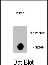 Rabbit Polyclonal Antibody to Phospho-BRAF(S445)