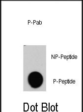 Rabbit Polyclonal Antibody to Phospho-RAF1(Y340)