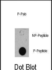 Rabbit Polyclonal Antibody to Phospho-TSC1(S505)