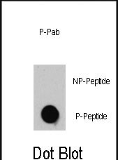 Rabbit Polyclonal Antibody to Phospho-TSC2(T1462)