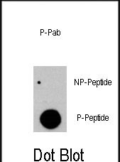 Rabbit Polyclonal Antibody to Phospho-RAF1(Y341)